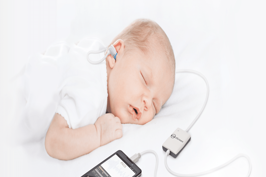 Neonatal Hearing Screening